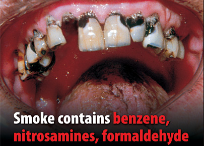 teeth_405.jpg